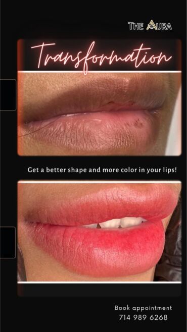 Neutralize Dark Lips with Lip Tattooing 1