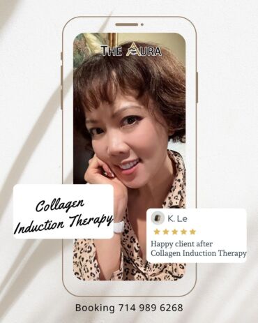 Collagen Induction Therapy & Skin Peel Rejuvination & BB Glow/ Microneedling treatment.