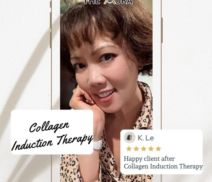 Collagen Induction Therapy & Skin Peel Rejuvination & BB Glow/ Microneedling treatment.