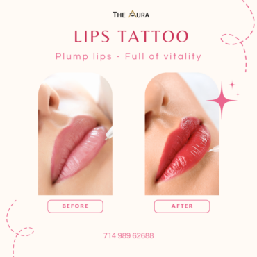 Plump lips - Full of vitality