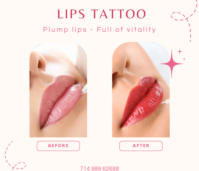 Plump lips - Full of vitality