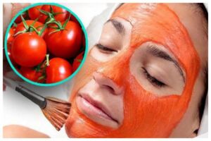 Facial Melasma Treatment with Traditional Remedies 6