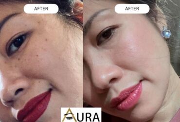 Skin Transformation: From Dry to Radiant