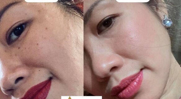 Skin Transformation: From Dry to Radiant