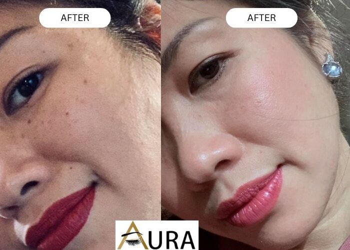 Skin Transformation: From Dry to Radiant