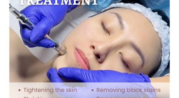 Facial treatment at The Aura – Your Path to Radiant Skin!