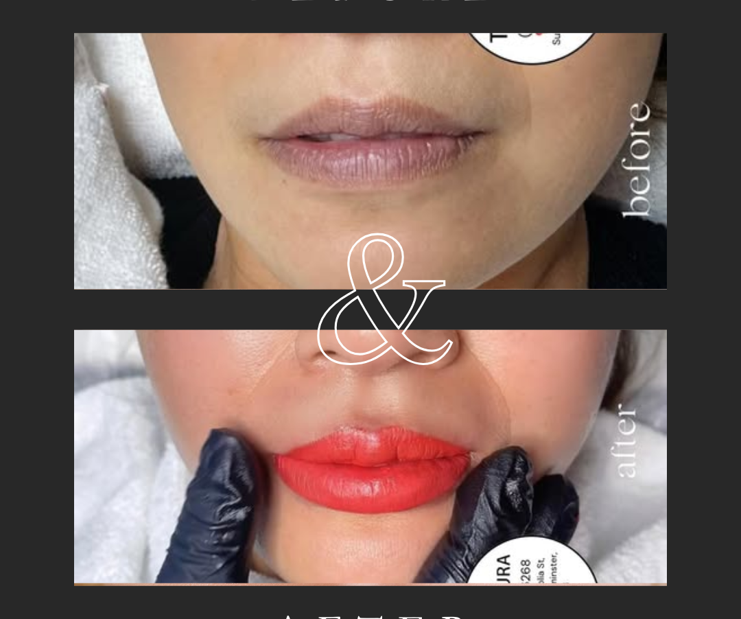 Lips Tattoo Before And After