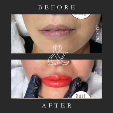 Lips Tattoo Before And After