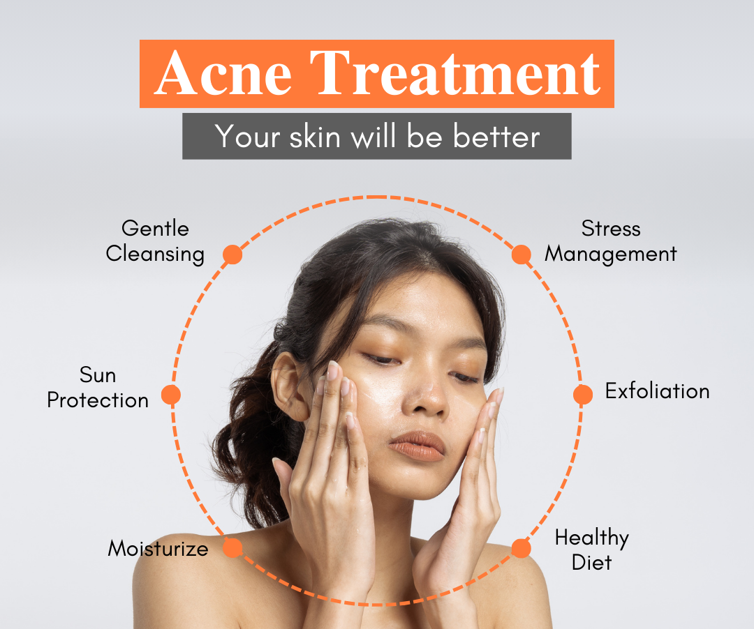 Acne Treatment