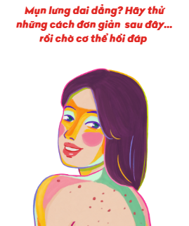 Mụn lưng mãi không dứt? Thử ngay 5 cách đơn giản – để làn da tự lên tiếng! 💧✨