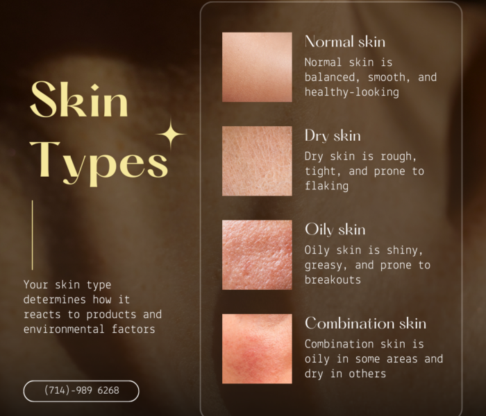 Skin Types