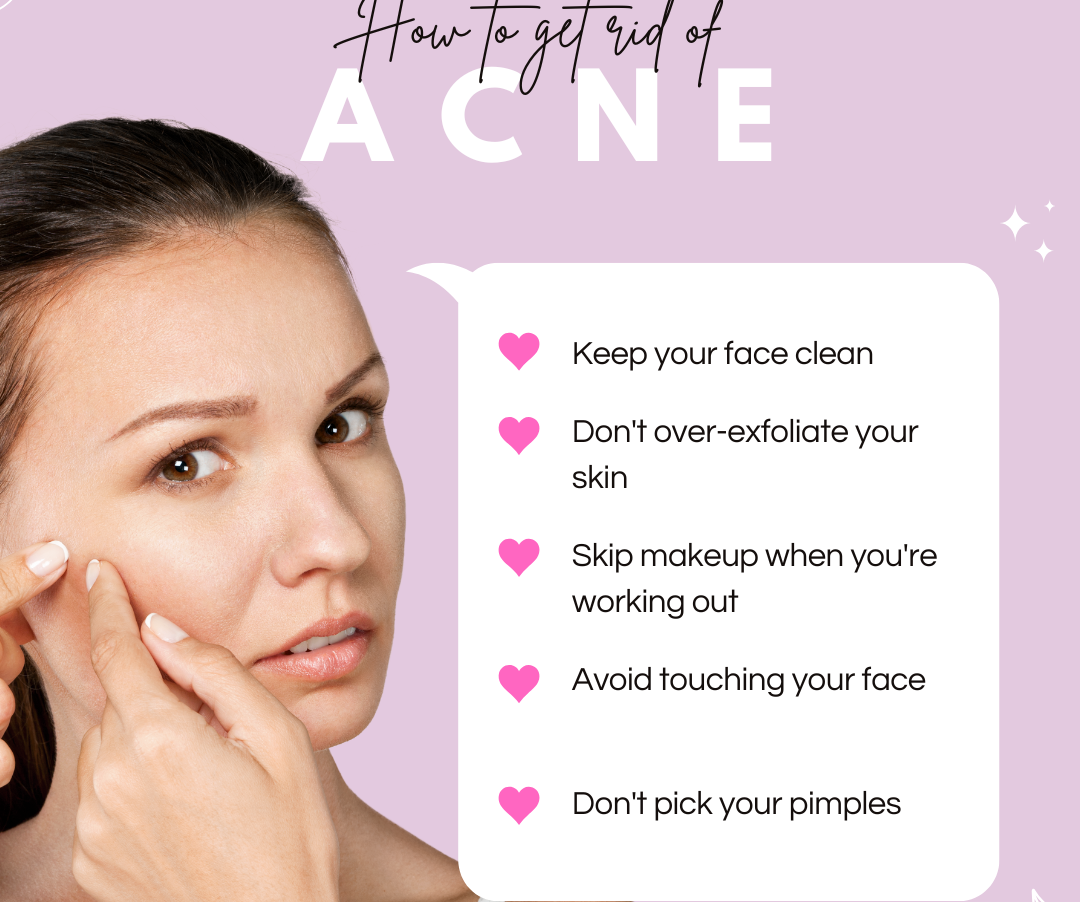 🌸How to get rid of acne🌸