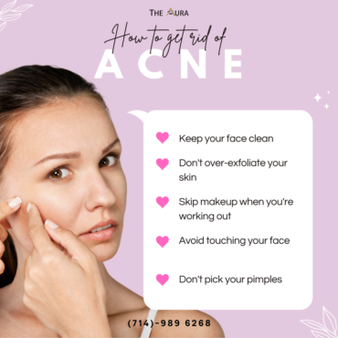 🌸How to get rid of acne🌸